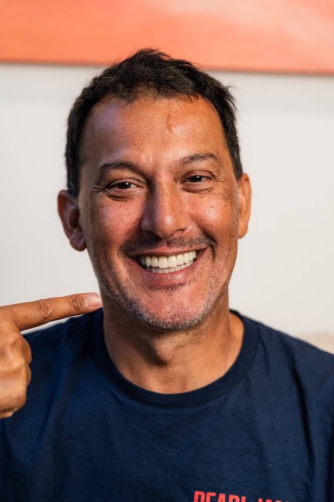 Ivor — All-on-4 patient result