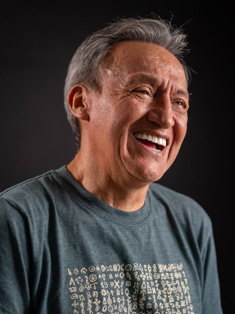 Gustavo — All-on-4 patient result