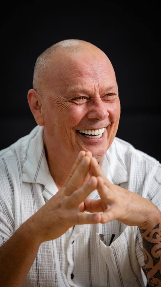 Devon — All-on-4 patient result